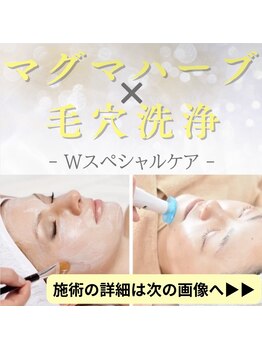 ルーセント/