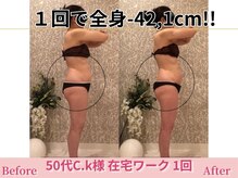 アメリイ 百合ヶ丘 新百合ヶ丘(Amerii)/【50代痩身】1回全身-42.1cm痩せ