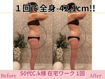 アメリイ 百合ヶ丘 新百合ヶ丘(Amerii)/【50代痩身】1回全身-42.1cm痩せ