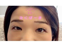 アリラアイ(ALiLa eye)/えくぱーま／エクパーマ