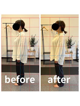 熊本カワル整体 JR上熊本駅院/ストレートネック・巻き肩