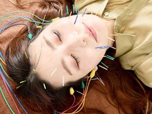 鍼灸ハリカラの雰囲気（美容鍼×整体×エステで【小顔/毛穴/たるみ】を改善◎贅沢ケア☆）