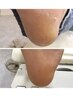 脱！かかとのガサガサ【足裏角質ケア】保湿パック付　¥5,000
