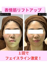 ユーフォリア(Euphoria)/フェイスラインが激変！