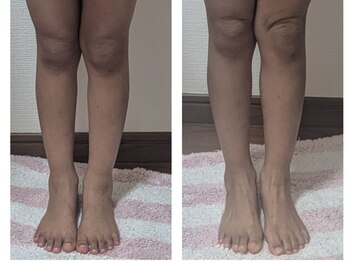 紬(TSUMUGI)/子供の『疲れた』はゆがみから