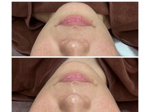 エスビーエス オキナワ(SBS OKINAWA)/