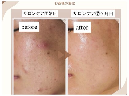 エムイーボーテ(me.Beaute)の写真