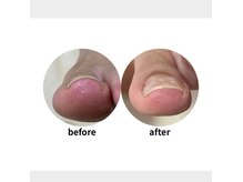 足つぼ・巻き爪専門店　フットケア蘇【SO】辛島店の雰囲気（頭痛、長年のお悩みに終止符を！目立ちにくく、普段の日常生活！）