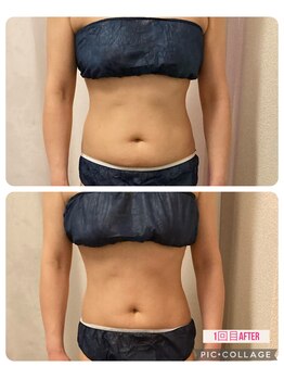 ベルフルールエム(Belle Fleur.M)/くびれが欲しい方◎