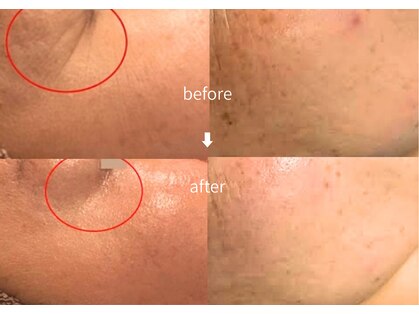 リリー(Lily.)の写真