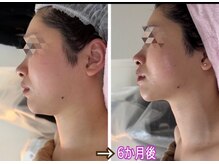アルページュ(Arpege)