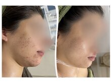 オアジスパ(Oasi Spa)の雰囲気（肌の状態によって選ぶホームケアがとても大事です。）