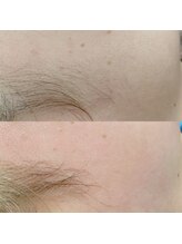 アイラッシュサロン ハル/フェイシャルワックス