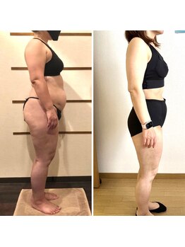 ソフィアアイズ 倉敷店(SOPHIAEYES)/エステプロラボでのダイエット