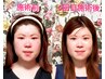 【お顔のトラブルに】シュプリームフェイシャル(顔+体の整え)