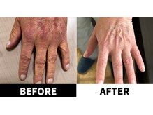 ありがとうパパの腸もみサロン アンド スクール/ビフォーアフター