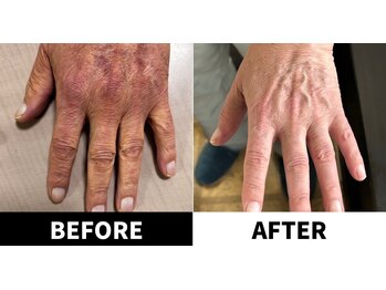 ありがとうパパの腸もみサロン アンド スクール/ビフォーアフター