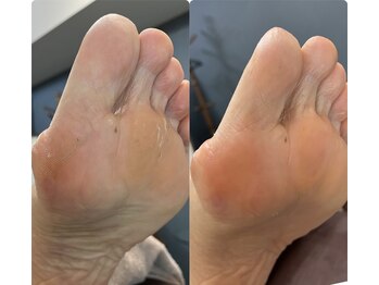 メグムサロン(Megumu Salon)/足つぼ/角質/空ルート整体