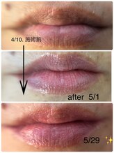 コルノ ラッシュアンドビヨンド(Corno Lash&beyond)/唇ローマピンク（50代）