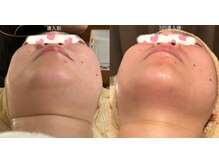 アンジュ/【レモンボトル】導入！