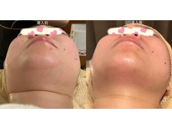 アンジュ/【レモンボトル】導入!