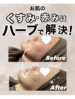 ビレボ マエバシ(BEREVO maebashi)/Before After