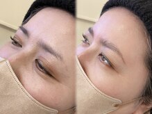 ミーククル(MEKUKURU)/眉毛-ハリウッドブロウリフト