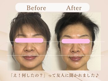 美カナエル(美kanaeru)/フェイシャル+ヘッドケア