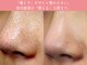 モアビューティー 庚午店(MORE BEAUTY)の写真