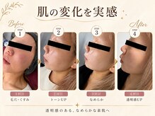 ヴァニーユ(Vanille)の雰囲気（肌本来の美しさを引き出し、理想の素肌へ★）