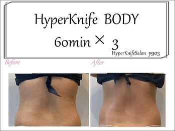 ワイキューマルサン(y903)/上半身60分×3回