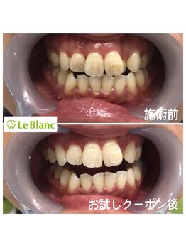 ルブラン 奈良店(Le Blanc)/なんと！なんと！びっくり！