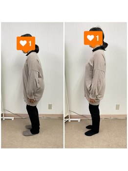 長岡痛み専門整体院みらい 長町店/Before&After