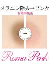 ラミーナ 札幌店(La Mina) Roma Pink 