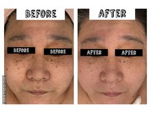 いおり骨盤整体 リブート(RE:BOOT)/ハーブピーリングとシミケア