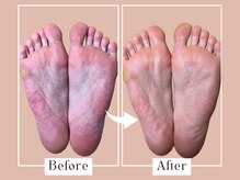 ベベ(Bebe)/女性/タコお悩み