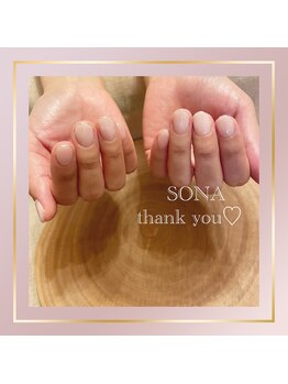 ソナ(Sona)/