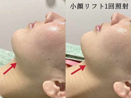 ホワイティアビシェル 浦和(Whitia Vishell)の写真