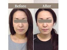 シェア 人形町店(Chare)の雰囲気（Chare独自の小顔・骨盤矯正・美容整体を体感してみて下さい♪）