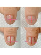 カンパニュラ(Campanula)/自爪育成