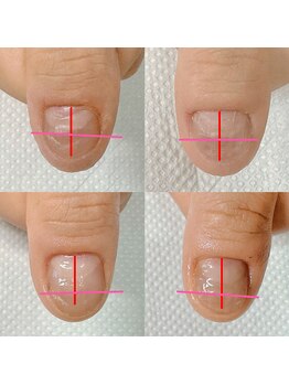 カンパニュラ(Campanula)/自爪育成