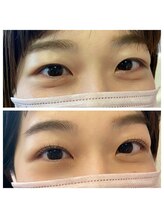 フィービー(pheebe)/ラッシュリフト