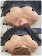 ルミネル 名古屋新栄(Luminelle)/バスト