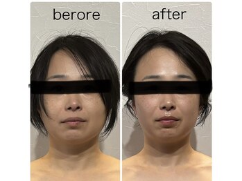 イトヒコ/ビフォーアフター