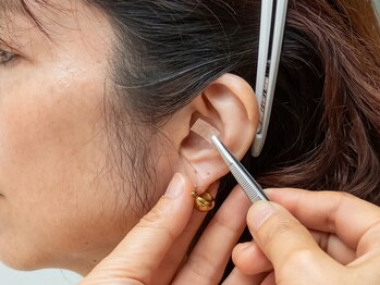 ナチュールフィット 宝塚店(Natur Fit)/耳ツボの施術♪