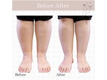 アロエ(Aloe)の雰囲気(ビフォーアフター)