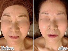 シャラ(shara)の雰囲気（たるみ・むくみ・歪み・年齢肌特化の戻らない顔ほぐし小顔矯正）