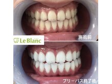 ルブラン 奈良店(Le Blanc)/思い立ったが吉日！