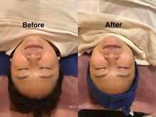 施術所ひびき庵/フェイシャルエステ♪