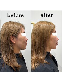 ラシンバン(Lashinvan)/コルギ